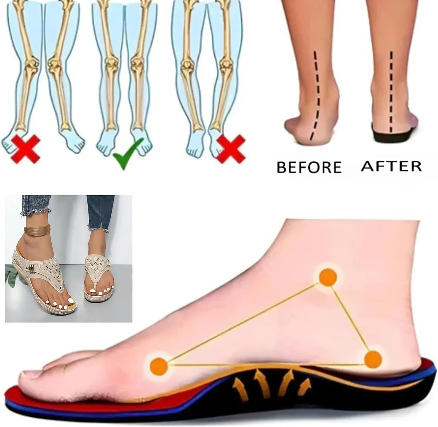 Breathable Mesh Hollow Sports Sandals Non-Slip 2024 New Women’s Wedge Orthopedic Flip-Flops Summer Casual Sandals Open Toe
